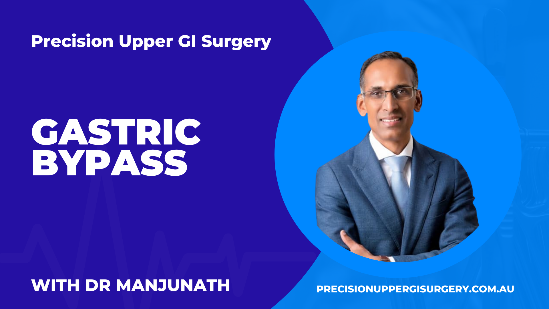 Gastric Bypass
