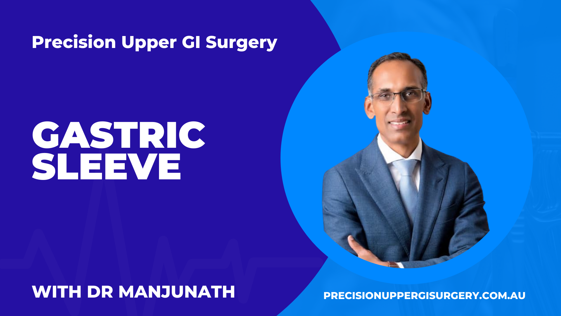 gastric sleeve