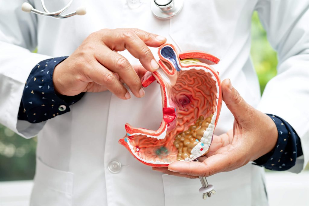 stomach model | gastrointestinal surgeon in Sydney