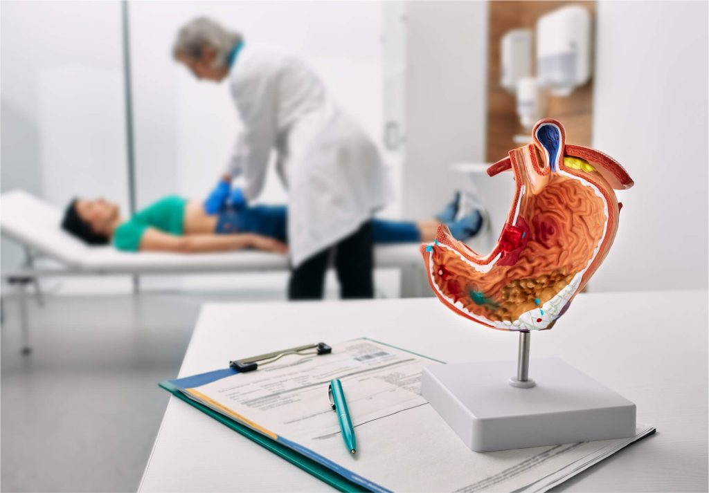 stomach model | gastrointestinal surgeon in Sydney